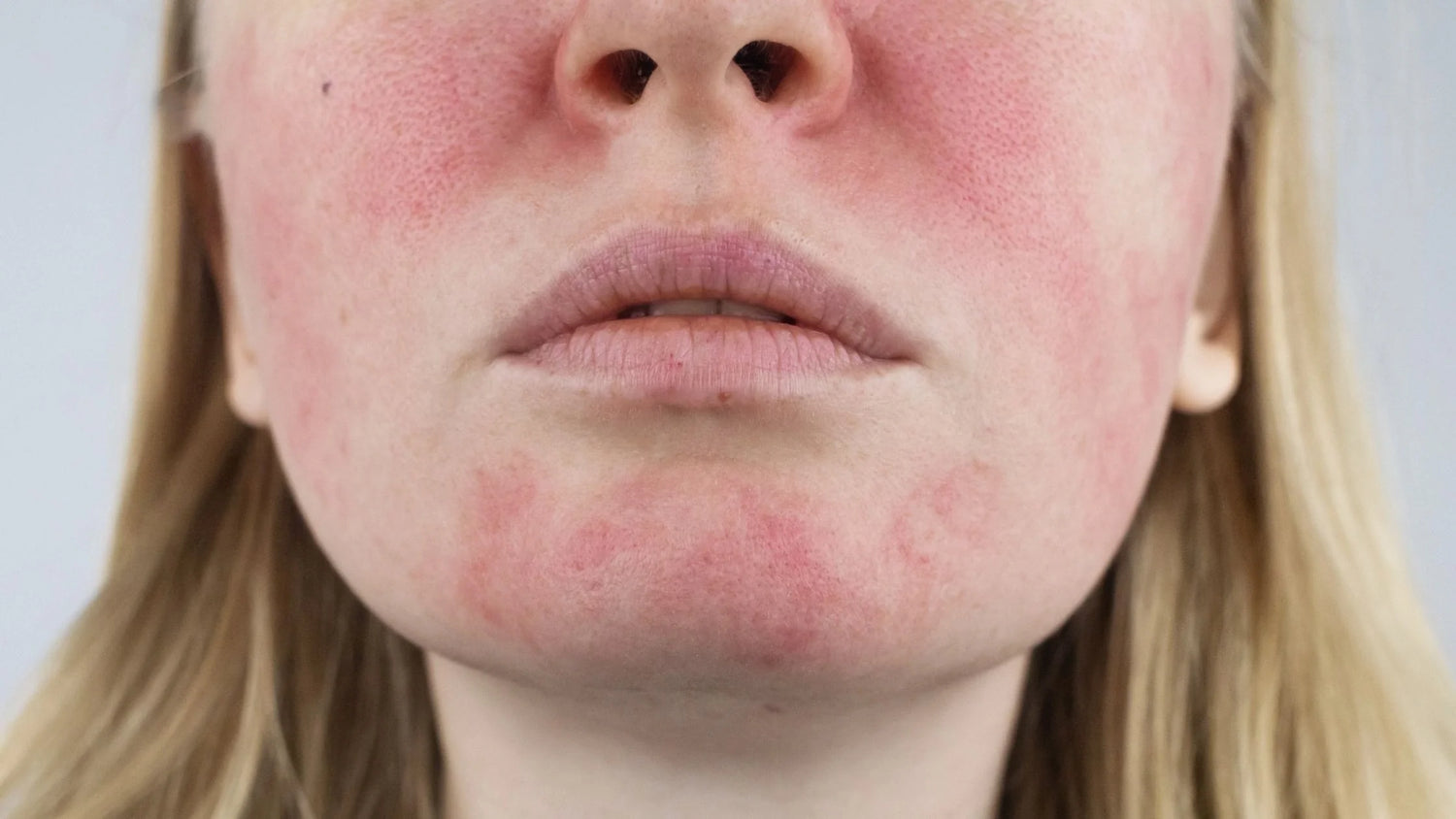 Soins pour peau sensible : la routine sans parfum