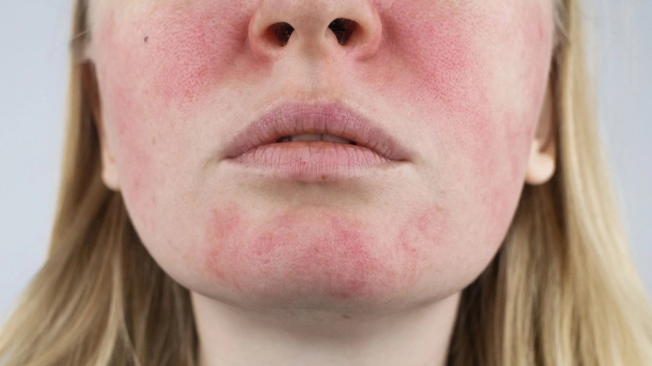 Soins pour peau sensible : la routine sans parfum