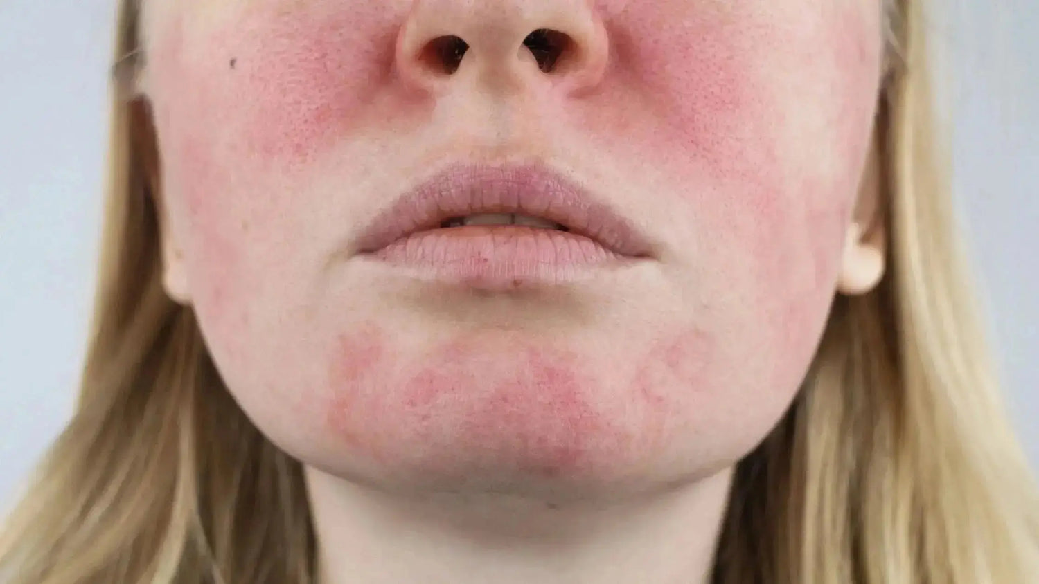 Soins pour peau sensible : la routine sans parfum - Les Pépites de Valou