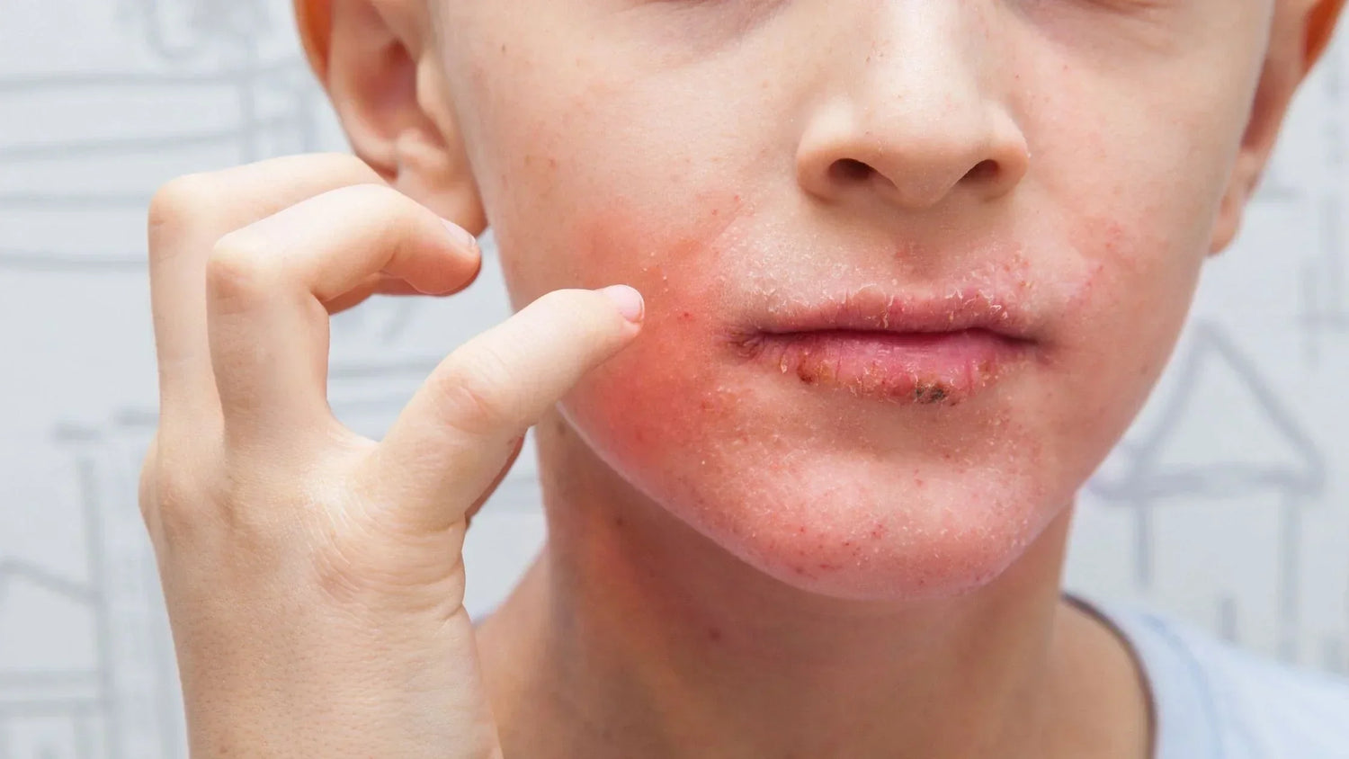 Huiles végétales peau allergique : options douces et sûres