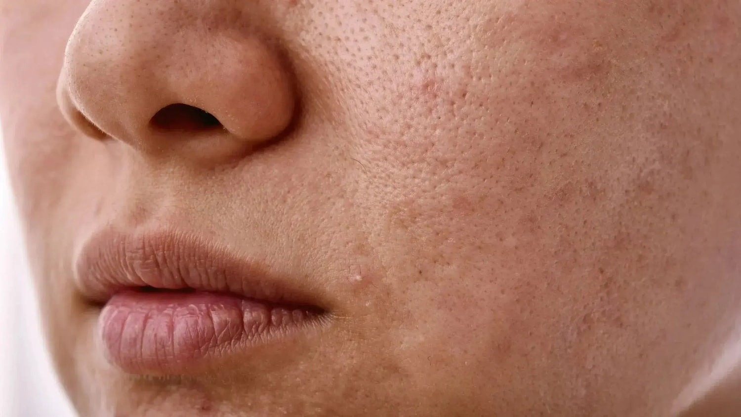 Meilleure huile végétale pour peau mixte : pourquoi choisir le jojoba - Les Pépites de Valou