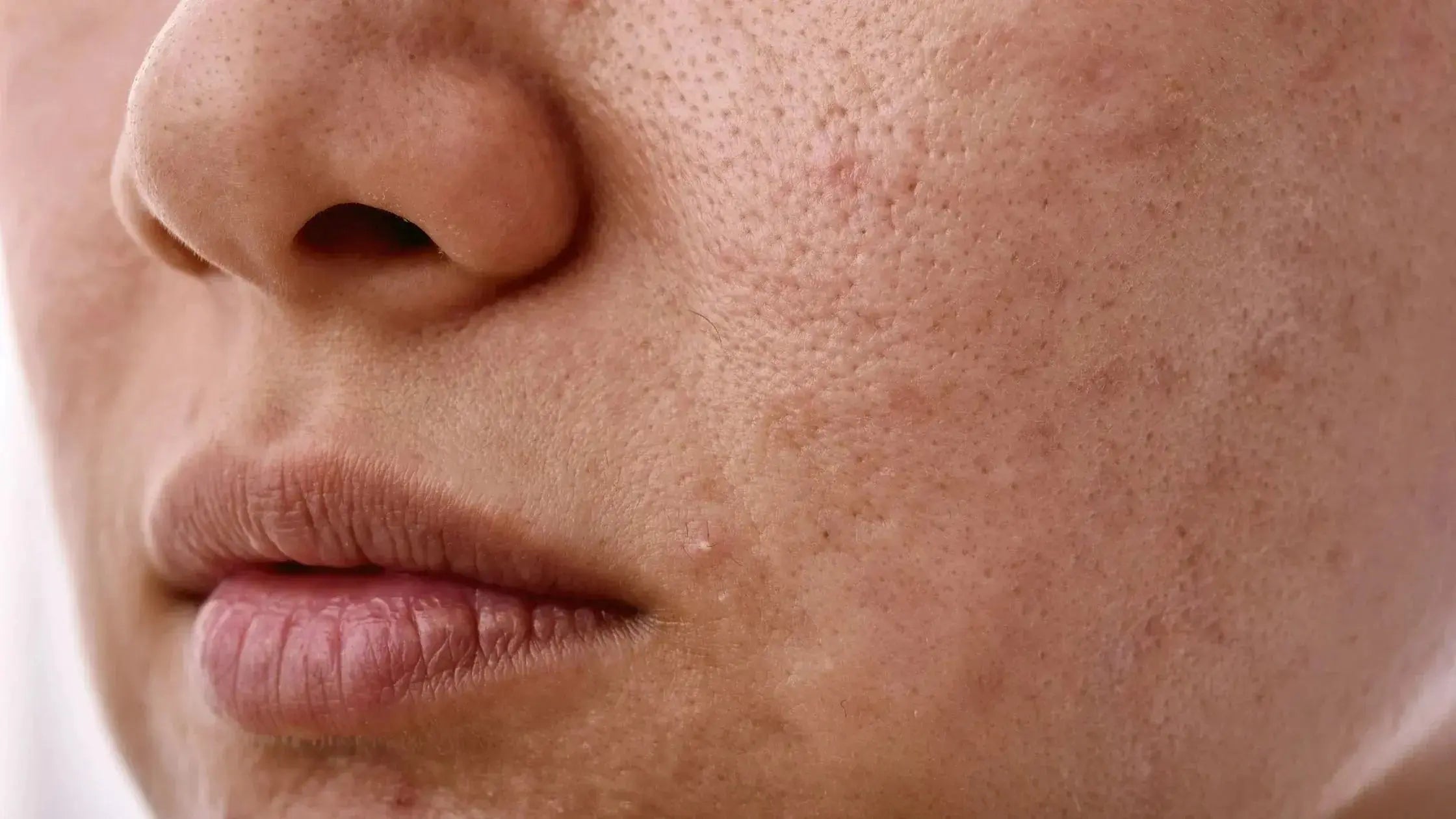 Meilleure huile végétale pour peau mixte : pourquoi choisir le jojoba - Les Pépites de Valou