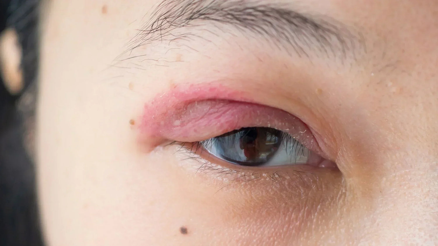 Contour des yeux pour peaux sensibles : quels soins choisir ?