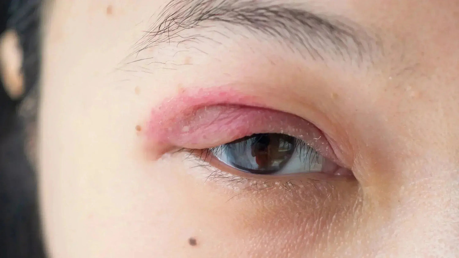 Contour des yeux pour peaux sensibles : quels soins choisir ? - Les Pépites de Valou