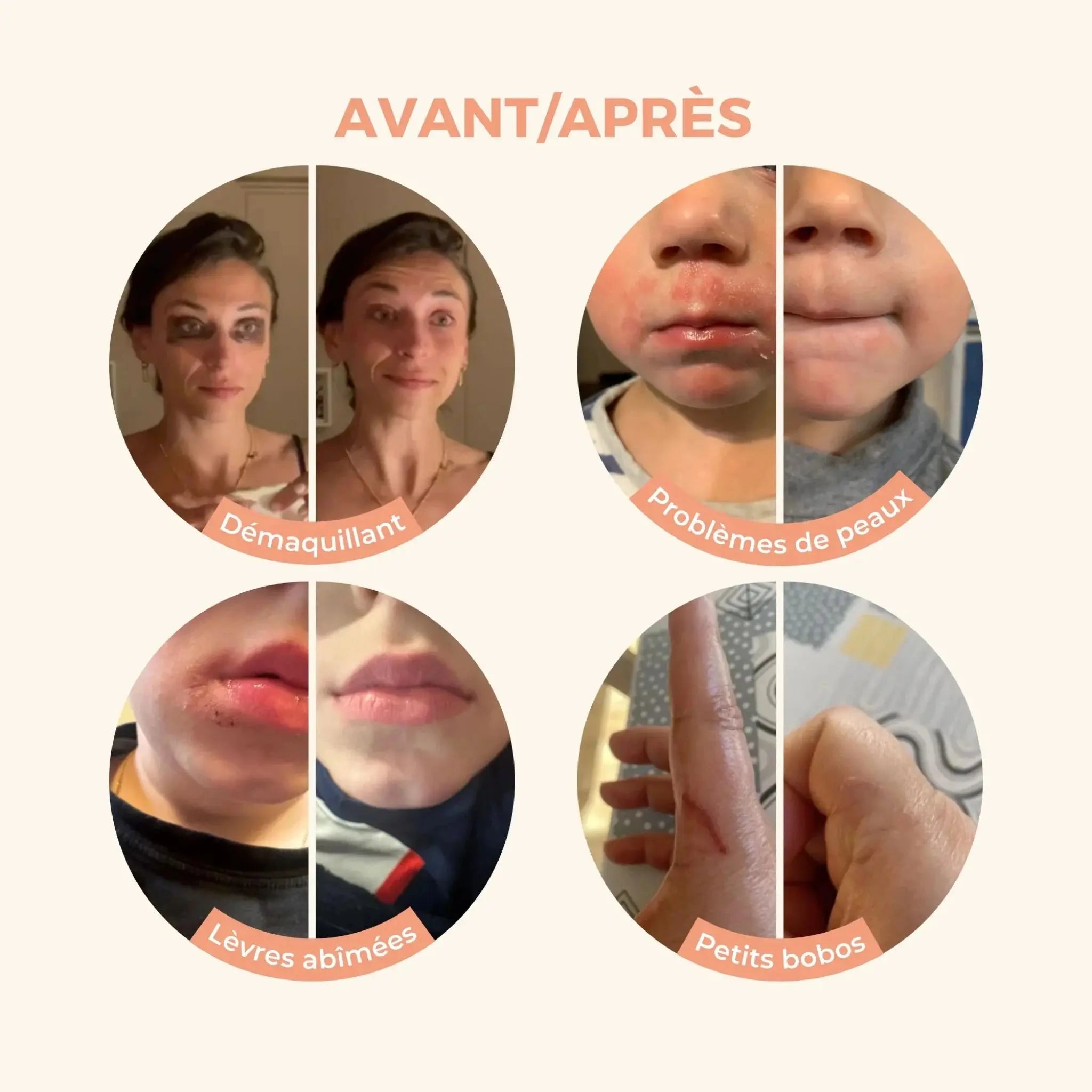 Baume Magique Apaisant Sans Parfum Les Petits Prodiges