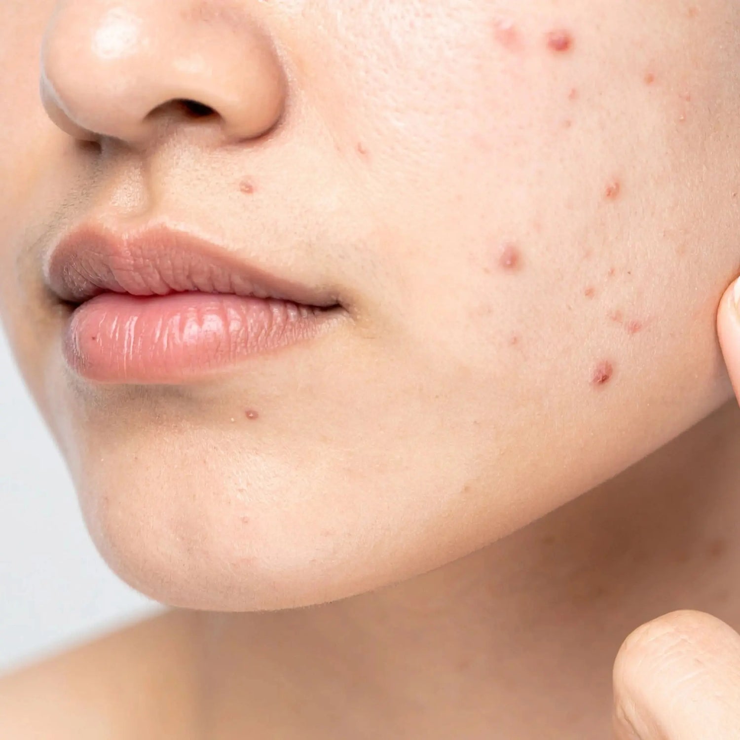 Sérum purifiant anti imperfections Waam